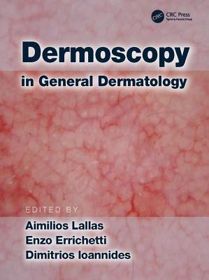 Dermoscopy in General Dermatology - Lallas, Aimilios (Editor), and Errichetti, Enzo (Editor), and Ioannides, Dimitrios (Editor)