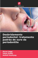 Desbridamento periodontal: tratamento padr?o de ouro da periodontite