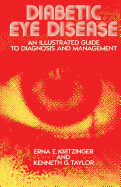 Diabetic Eye Disease: An Illustrated Guide to Diagnosis and Management