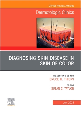 Diagnosing Skin Disease in Skin of Color, an Issue of Dermatologic Clinics: Volume 41-3 - Taylor, Susan C, MD (Editor)