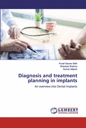 Diagnosis and treatment planning in implants