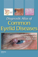 Diagnostic Atlas of Common Eyelid Diseases