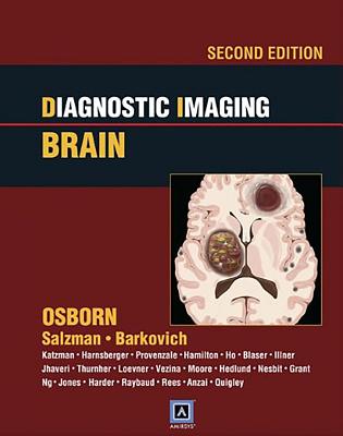 Diagnostic Imaging: Brain - Osborn, Anne G, MD, and Salzman, Karen L, MD, and Barkovich, A James, MD