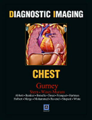 Diagnostic Imaging: Chest - Gurney, Jud W., and Winer-Muram, Helen T., and Stern, Eric