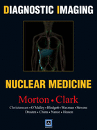 Diagnostic Imaging: Nuclear Medicine - O'Malley, Janis P, MD, and Thomas, Anita, MD, and Heston, Thomas F, MD