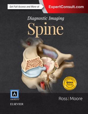 Diagnostic Imaging: Spine - Ross, Jeffrey S, MD, and Moore, Kevin R, MD