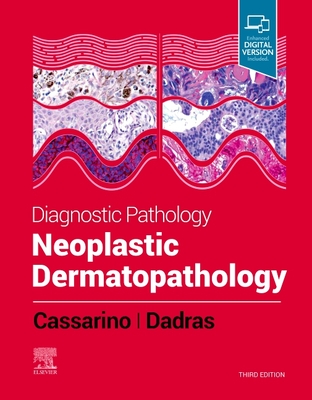 Diagnostic Pathology: Neoplastic Dermatopathology - Cassarino, David S, MD, PhD