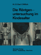 Die Rntgenuntersuchung Im Kindesalter: Technik Und Indikation