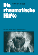 Die Rheumatische Hufte - Thabe, Heiner