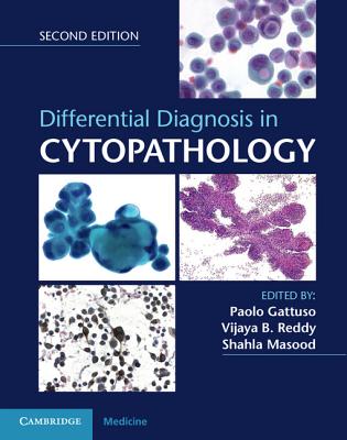 Differential Diagnosis in Cytopathology Book and Online Bundle - Gattuso, Paolo (Editor), and Reddy, Vijaya B. (Editor), and Masood, Shahla (Editor)