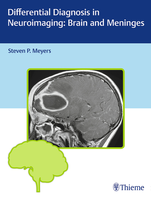 Differential Diagnosis in Neuroimaging: Brain and Meninges - Meyers, Steven P. (Editor)