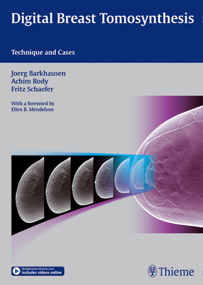 Digital Breast Tomosynthesis: Technique and Cases - Barkhausen, Joerg, and Rody, Achim, and Schfer, Fritz K.W.