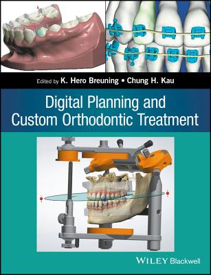 Digital Planning and Custom Orthodontic Treatment - Breuning, K. Hero (Editor), and Kau, Chung H. (Editor)