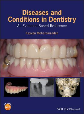 Diseases and Conditions in Dentistry: An Evidence-Based Reference - Moharamzadeh, Keyvan