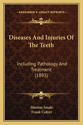 Diseases and Injuries of the Teeth: Including Pathology and Treatment (1893) - Smale, Morton, and Colyer, Frank