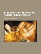 Diseases of the skin and the eruptive fevers