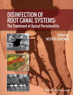 Disinfection of Root Canal Systems: The Treatment of Apical Periodontitis - Cohenca, Nestor (Editor)