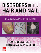 Disorders of the Hair and Nail: Diagnosis and Treatment