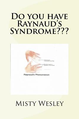 Do you have Raynaud's Syndrome - Wesley, Misty Lynn