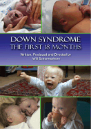 Down Syndrome Dvd: the First 18 Months