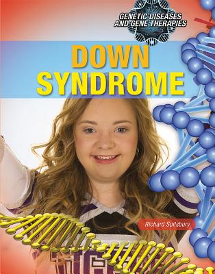 Down Syndrome - Spilsbury, Richard