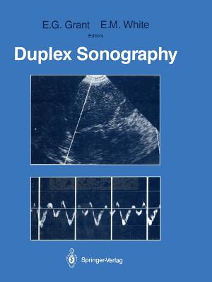 Duplex Sonography - Grant, Edward G, MD (Editor), and White, E Maureen (Editor)