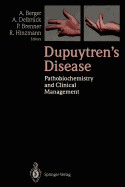 Dupuytren's Disease: Pathobiochemistry and Clinical Management