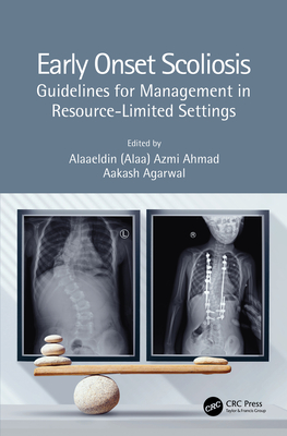 Early Onset Scoliosis: Guidelines for Management in Resource-Limited Settings - Ahmad (Editor), and Agarwal, Aakash (Editor)