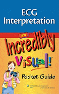 ECG Interpretation: An Incredibly Visual! Pocket Guide