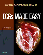 ECGs Made Easy