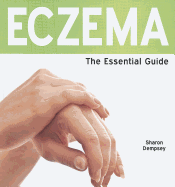 Eczema: The Essential Guide
