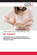 El Cagut