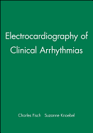 Electrocardiography of Clinical Arrhythmias