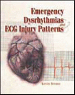 Emergency Dysrhythmias and ECG Injury Patterns