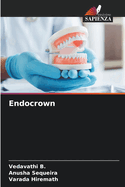 Endocrown