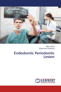 Endodontic Periodontic Lesion