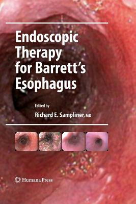 Endoscopic Therapy for Barrett's Esophagus - Sampliner, Richard E (Editor)