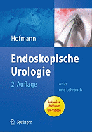 Endoskopische Urologie: Atlas Und Lehrbuch