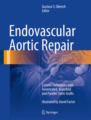 Endovascular Aortic Repair: Current Techniques with Fenestrated, Branched and Parallel Stent-Grafts - Oderich, Gustavo S. (Editor)