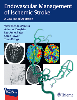 Endovascular Management of Ischemic Stroke: A Case-Based Approach - Pereira, Vitor, and Dmytriw, Adam, and Slater, Lee-Anne