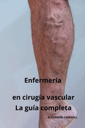 Enfermera en ciruga vascular - La gua completa