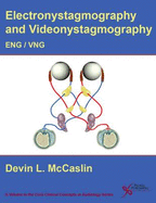 Eng/Vng: Electronystagmography/ Videonystagmography