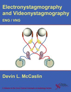 Eng/Vng: Electronystagmography/ Videonystagmography - McCaslin, Devin L