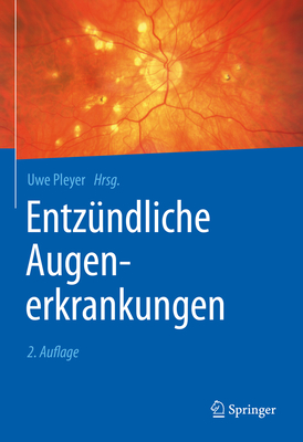 Entzundliche Augenerkrankungen - Pleyer, Uwe (Editor)