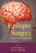 Epilepsy Surgery: Principles and Controversies