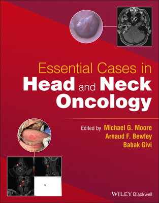 Essential Cases in Head and Neck Oncology - Moore, Michael G (Editor), and Bewley, Arnaud F (Editor), and Givi, Babak (Editor)