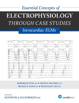 Essential Concepts of Electrophysiology Through Case Studies: Intracardiac EGMs: Intracardiac EGMs - Ellenbogen, Kenneth a (Editor), and Tung, Roderick (Editor), and Frankel, David (Editor)