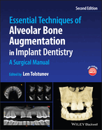 Essential Techniques of Alveolar Bone Augmentation in Implant Dentistry: A Surgical Manual