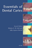 Essentials of Dental Caries: The Disease and Its Management