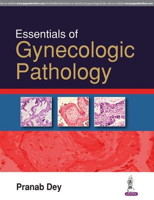 Essentials of Gynecologic Pathology - Dey, Pranab